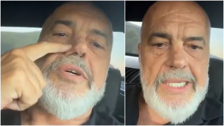 Edi Rama sqaron nga Pogradeci origjinën e shenjës në hundë